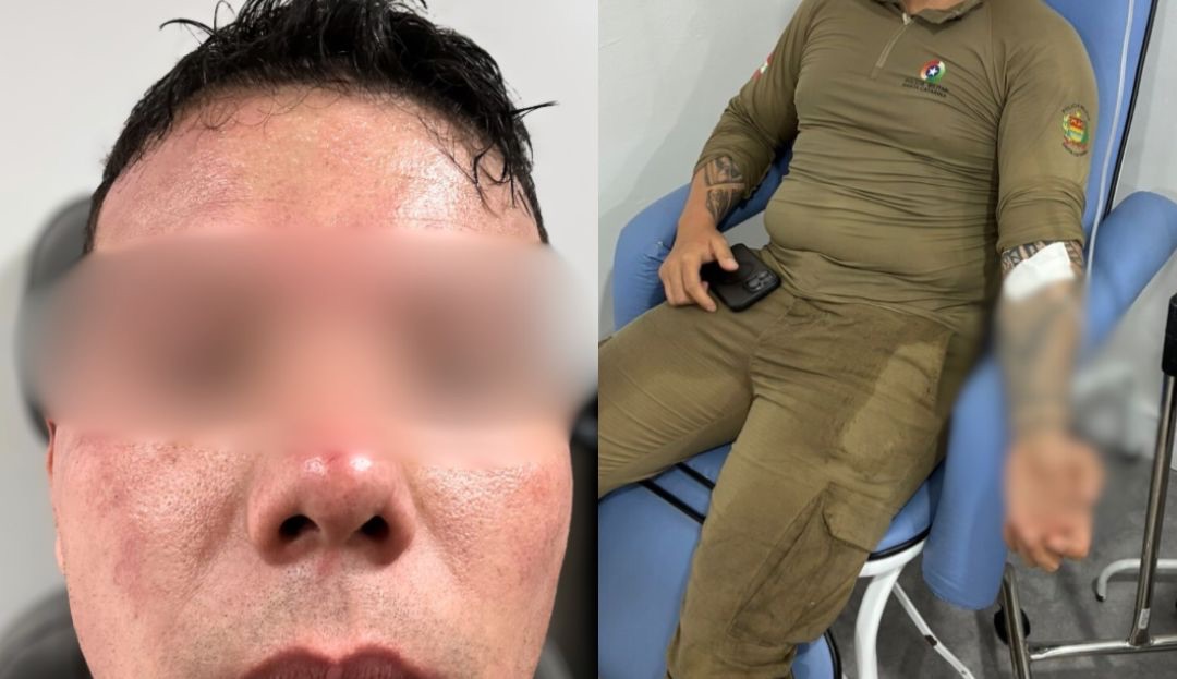 PMs levam 90 picadas, ignoram a dor e ‘se jogam no mato’ para prender ladrão em SC