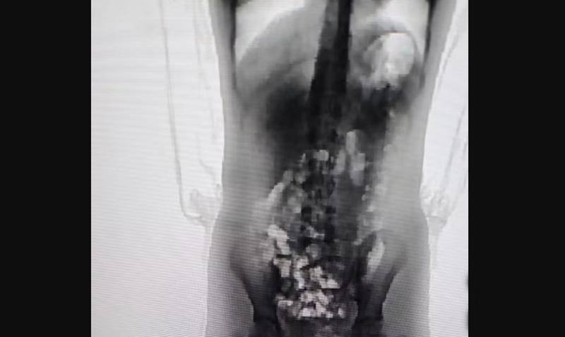 Adolescente de 13 anos é flagrada com "supermaconha" dentro do corpo em presídio de SC