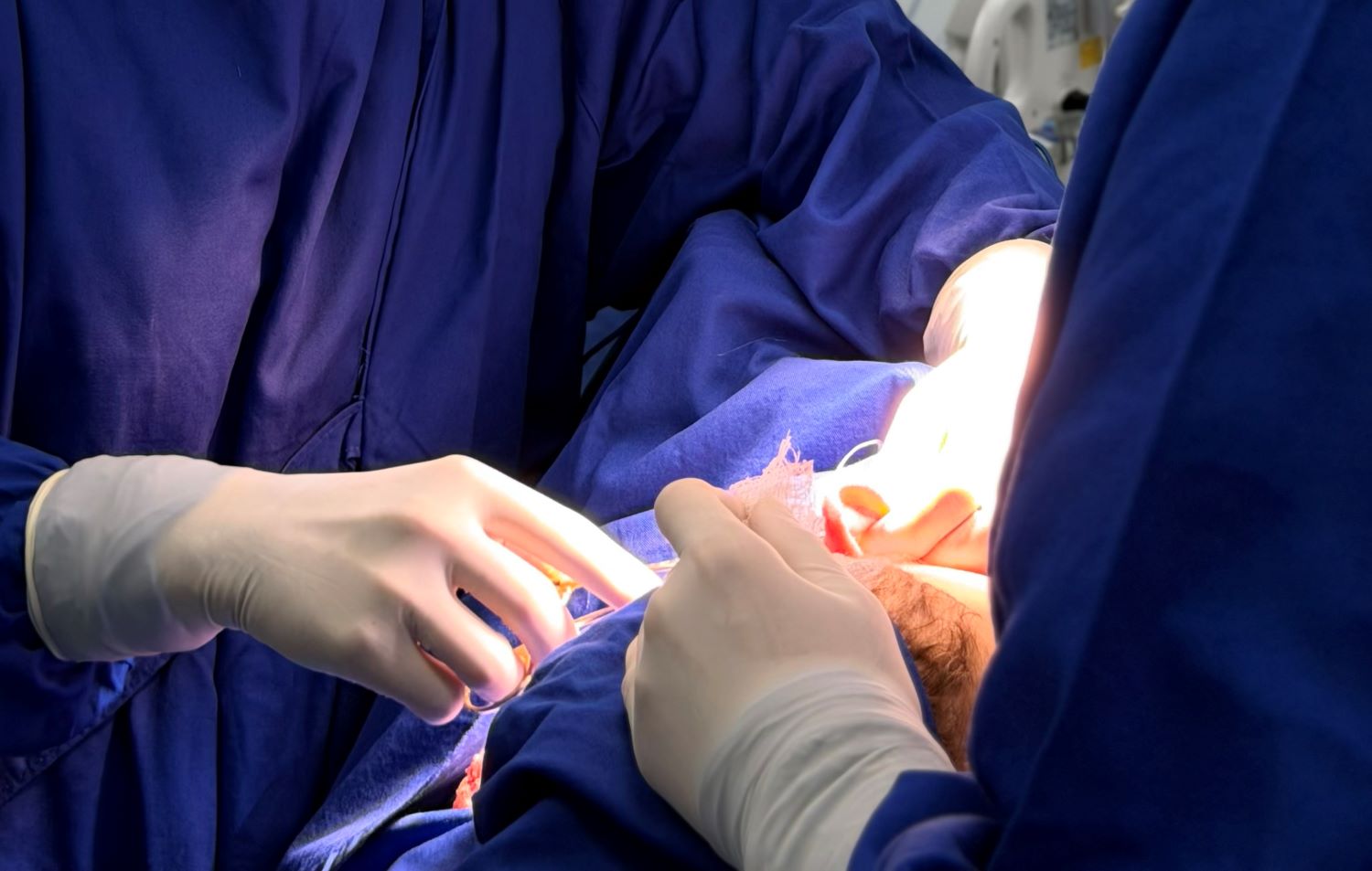 Hospital Infantil Joana de Gusmão promove ação de cirurgias para correção de orelhas proeminentes